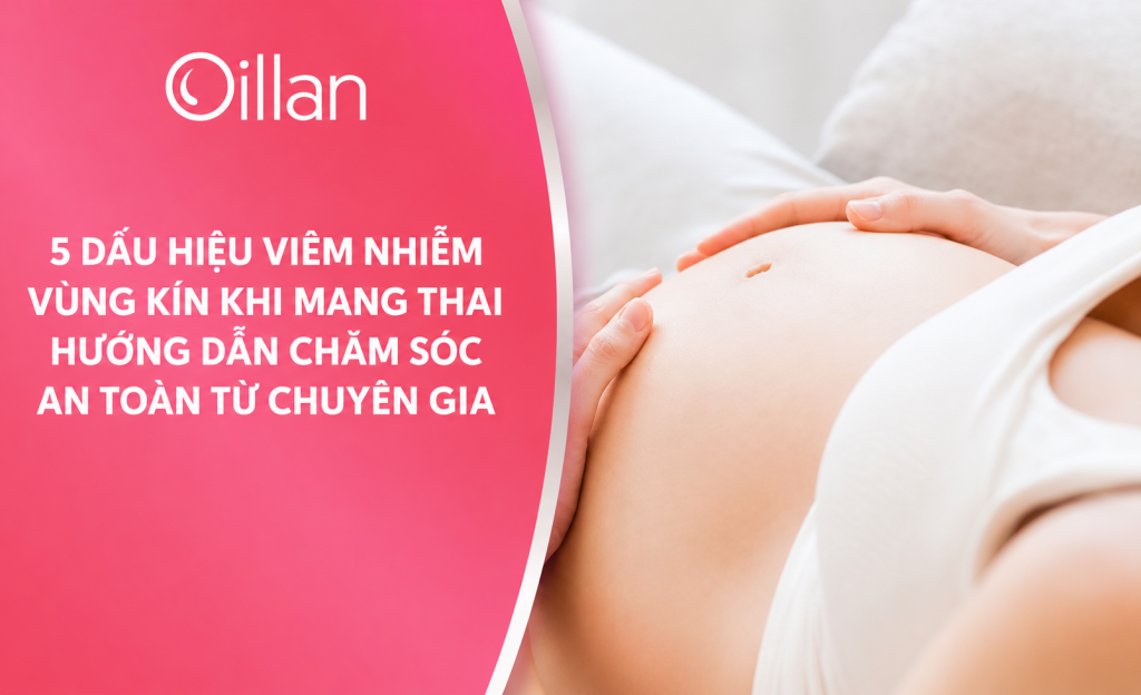 Oillan